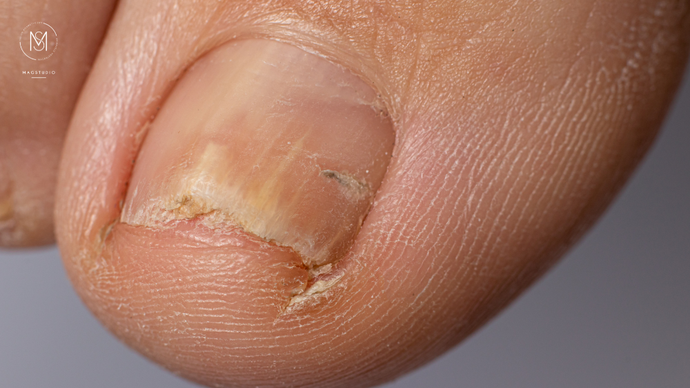 Podologia w MagStudio Zalasewo