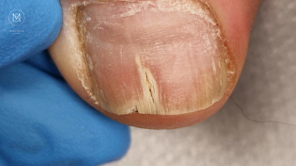 Podologia w MagStudio Zalasewo