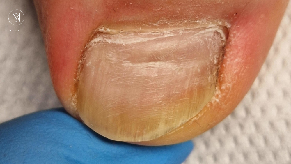 Podologia w MagStudio Zalasewo