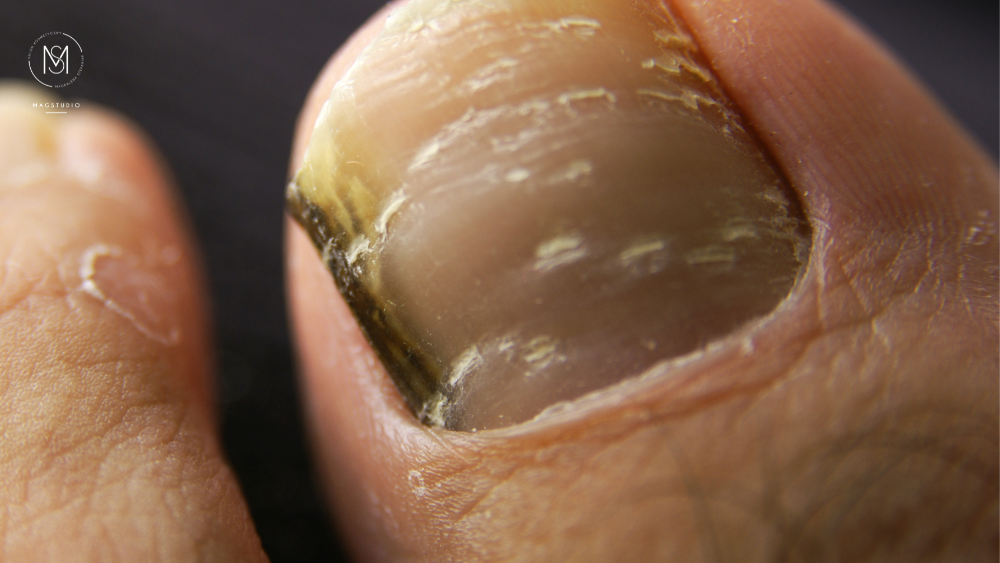 Podologia w MagStudio Zalasewo