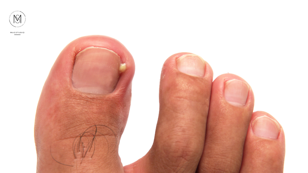 Podologia MagStudio Zalasewo (1)