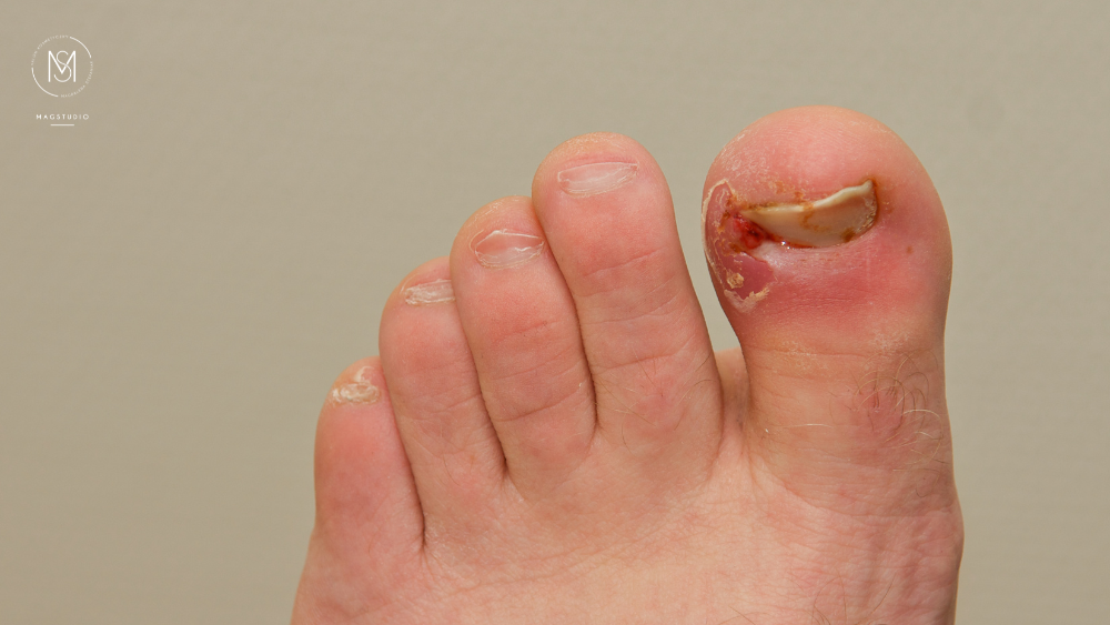 Podologia MagStudio Zalasewo (1)