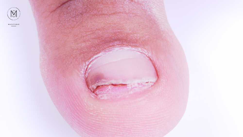 Podologia MagStudio Zalasewo (1)