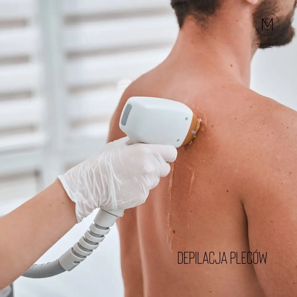 depilacja pleców